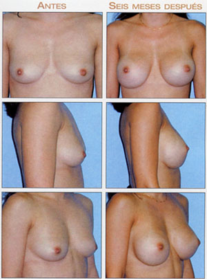 cosmetic surgery