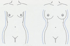 flastic surgery